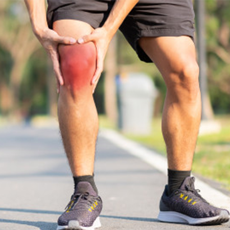 Patellofemoral Pain Syndrome