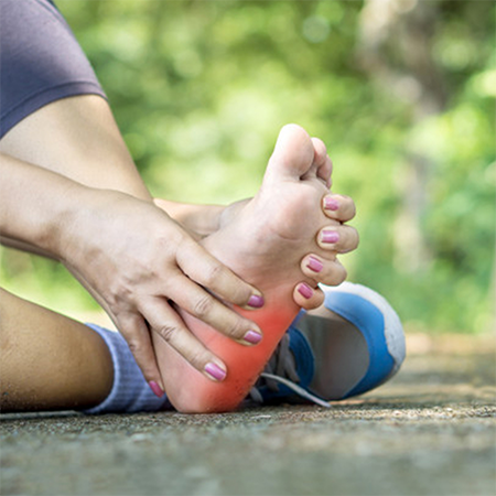 Plantar-fasciitis