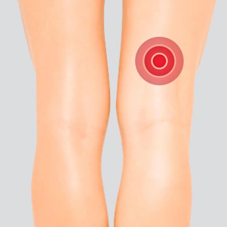Hamstring strains